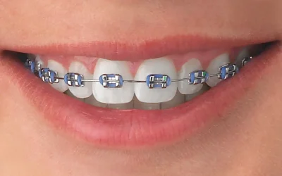 Teeth-MiniMaster-1-1.jpg