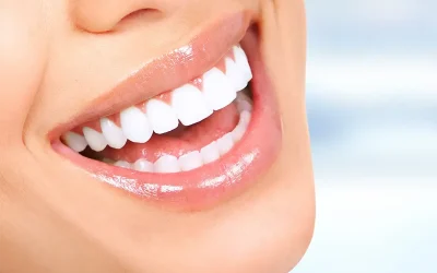 hollywood-smile-1720303912